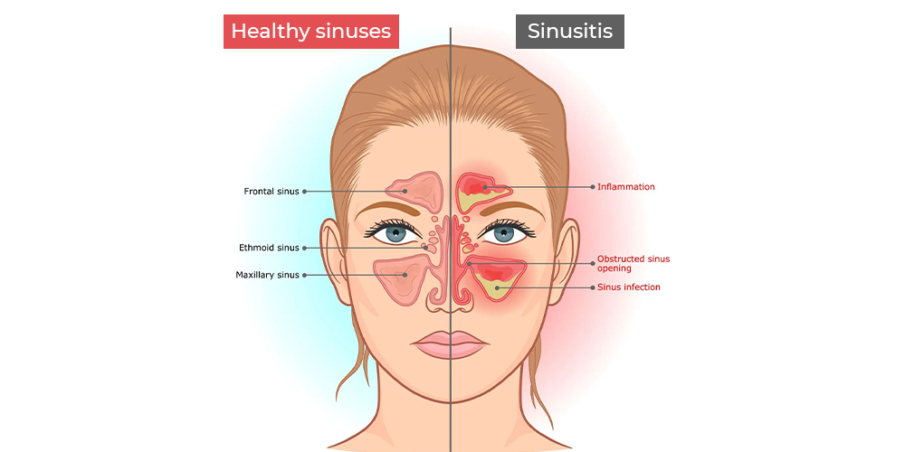 healthy-sinuses